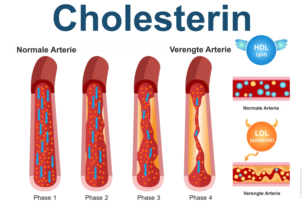 Cholesterin HDL und LDL